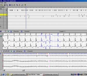 NORAV HOLTER EKG SOFTWARE NH 300-3