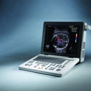 ECOGRAF PORTABIL – SONOACE R3-DOPPLER COLOR