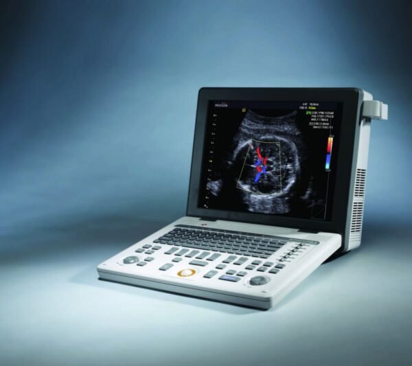 ECOGRAF PORTABIL – SONOACE R3-DOPPLER COLOR